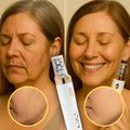 Cléoria® EpilSmooth Épilateur visage